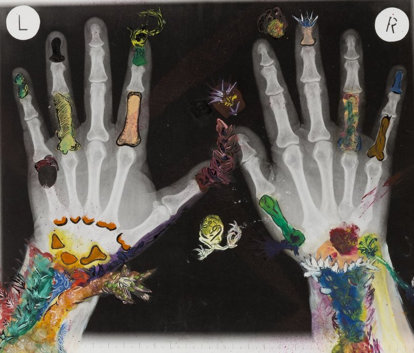 Archiv-Bild „Röntgen-Phantasie“