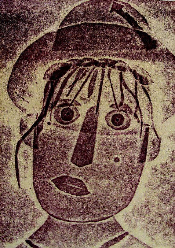 Archiv-Bild „Susi Sonnenbrand“