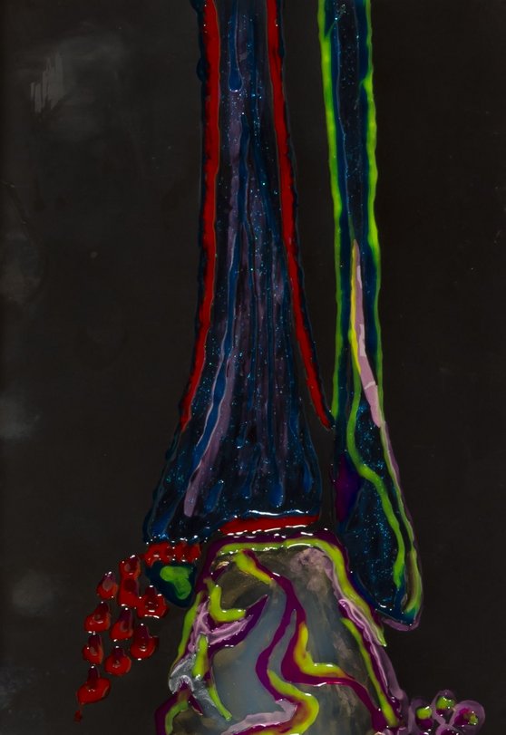 Archiv-Bild „Röntgen-Phantasie“