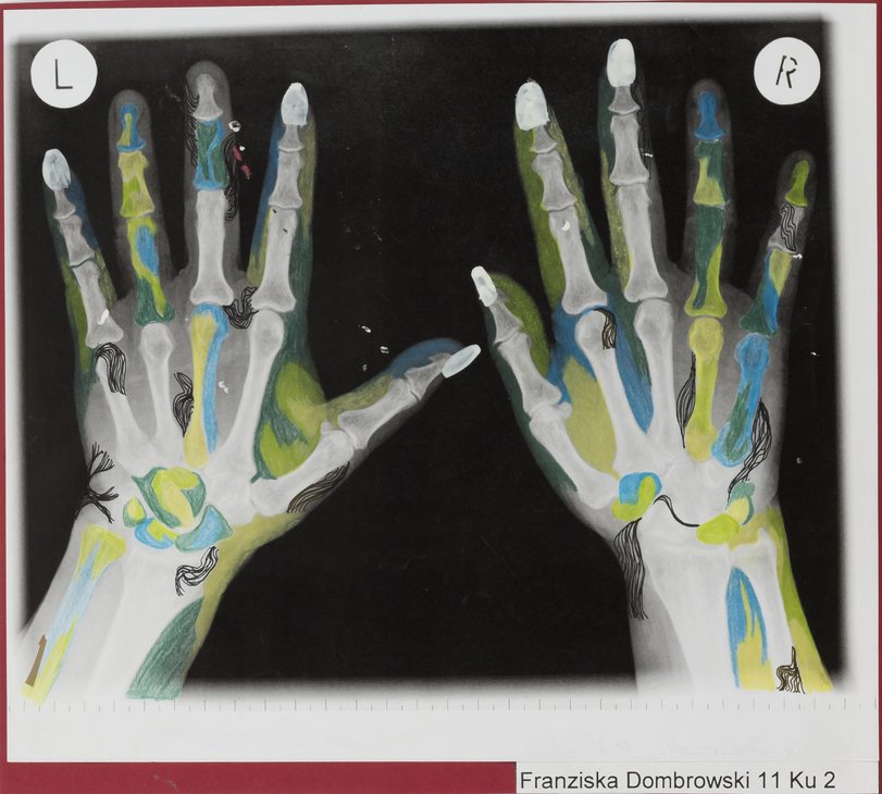 Archiv-Bild „Röntgen-Phantasie“