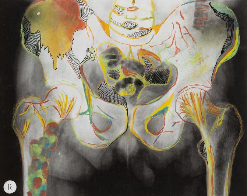 Archiv-Bild „Röntgen-Phantasie“